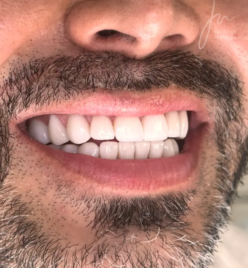 38