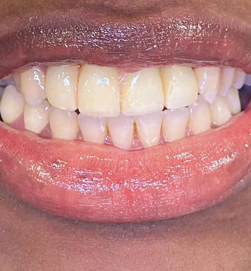 nayibe2
